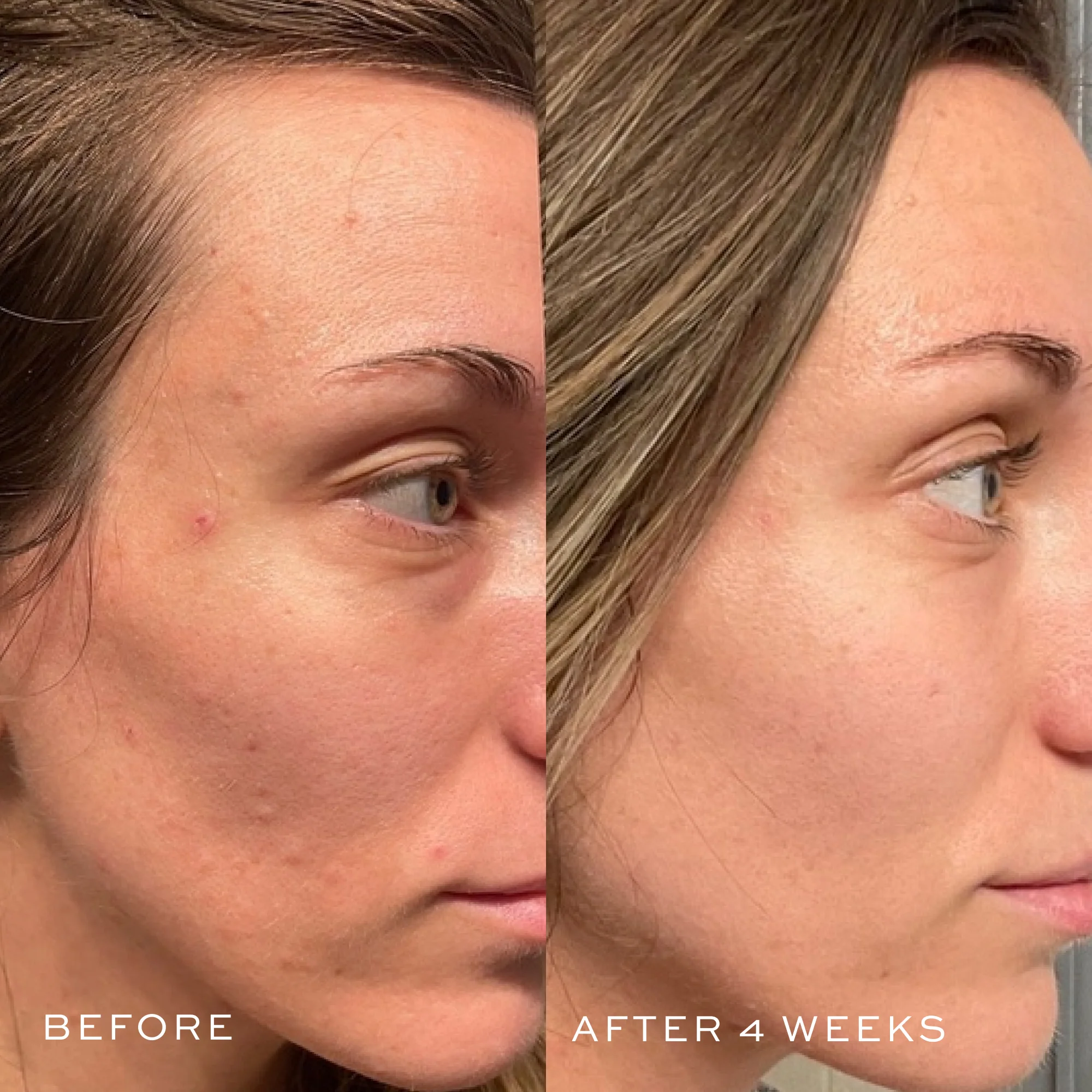 Jumbo Hyaluronic Acid Serum - Image 5